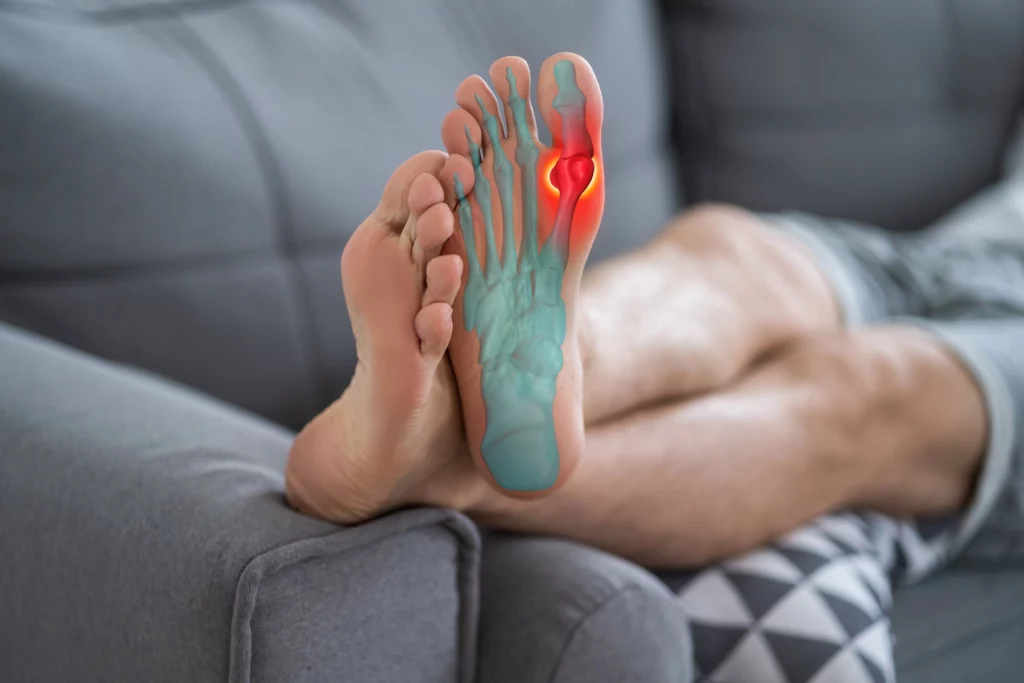 Man taking rest while keeping his feet inclined at sofa - Brachymetatarsia Treatment at Integrity Foot and Ankle