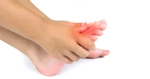 Athlete experiencing ankle pain during training