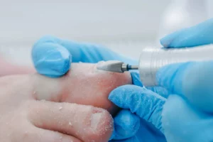 How Cosmetic Nail Restoration Is Changing the Beauty Industry