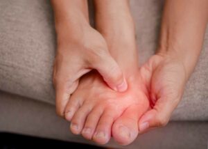 Person holding a foot with redness and pain around the little toe, showing a possible Tailor's bunion